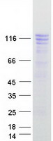 GTF3 / GTF2IRD1 Protein - Purified recombinant protein GTF2IRD1 was analyzed by SDS-PAGE gel and Coomassie Blue Staining