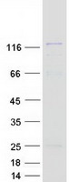 GTF3 / GTF2IRD1 Protein - Purified recombinant protein GTF2IRD1 was analyzed by SDS-PAGE gel and Coomassie Blue Staining