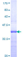 GTF3A Protein - 12.5% SDS-PAGE Stained with Coomassie Blue.