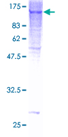 GTF3C2 Protein - 12.5% SDS-PAGE of human GTF3C2 stained with Coomassie Blue