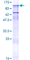 GTF3C3 Protein - 12.5% SDS-PAGE of human GTF3C3 stained with Coomassie Blue