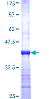GTF3C5 Protein - 12.5% SDS-PAGE Stained with Coomassie Blue.