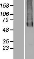 GTPBP2 Protein - Western validation with an anti-DDK antibody * L: Control HEK293 lysate R: Over-expression lysate