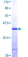 GTPBP2 Protein - 12.5% SDS-PAGE Stained with Coomassie Blue.