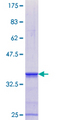 GTPBP3 Protein - 12.5% SDS-PAGE Stained with Coomassie Blue.