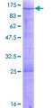 GTPBP4 Protein - 12.5% SDS-PAGE of human GTPBP4 stained with Coomassie Blue