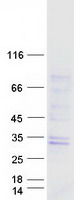 GTPBP8 / HSPC135 Protein - Purified recombinant protein GTPBP8 was analyzed by SDS-PAGE gel and Coomassie Blue Staining