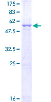GTPCH1 / GCH1 Protein - 12.5% SDS-PAGE of human GCH1 stained with Coomassie Blue