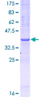 GTPCH1 / GCH1 Protein - 12.5% SDS-PAGE Stained with Coomassie Blue.