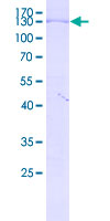 GTSE1 Protein - 12.5% SDS-PAGE Stained with Coomassie Blue