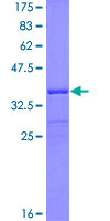 GTSE1 Protein - 12.5% SDS-PAGE Stained with Coomassie Blue.