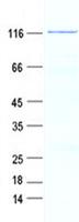 GTSE1 Protein