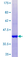GUCA2A / Guanylin Protein - 12.5% SDS-PAGE of human GUCA2A stained with Coomassie Blue