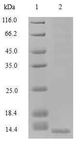 GUCA2B / Uroguanylin Protein - (Tris-Glycine gel) Discontinuous SDS-PAGE (reduced) with 5% enrichment gel and 15% separation gel.
