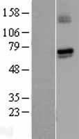 GUCY1A1 / GUCY1A3 Protein - Western validation with an anti-DDK antibody * L: Control HEK293 lysate R: Over-expression lysate