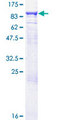 GUCY1A1 / GUCY1A3 Protein - 12.5% SDS-PAGE of human GUCY1A3 stained with Coomassie Blue
