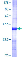 GUCY1A2 Protein - 12.5% SDS-PAGE Stained with Coomassie Blue.