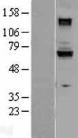 GUCY1B3 Protein - Western validation with an anti-DDK antibody * L: Control HEK293 lysate R: Over-expression lysate