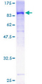 GUCY1B3 Protein - 12.5% SDS-PAGE of human GUCY1B3 stained with Coomassie Blue