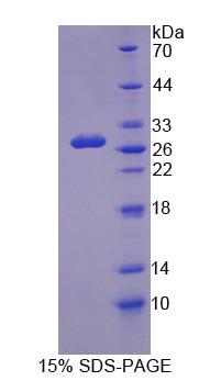 GUCY1B3 Protein - Recombinant  Guanylate Cyclase 1 Beta 3 By SDS-PAGE