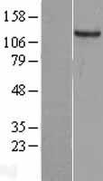 GUCY2C / Guanylyl Cyclase C Protein - Western validation with an anti-DDK antibody * L: Control HEK293 lysate R: Over-expression lysate