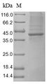GUCY2C / Guanylyl Cyclase C Protein - (Tris-Glycine gel) Discontinuous SDS-PAGE (reduced) with 5% enrichment gel and 15% separation gel.