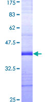 GUCY2C / Guanylyl Cyclase C Protein - 12.5% SDS-PAGE Stained with Coomassie Blue.