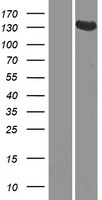 GUCY2D Protein - Western validation with an anti-DDK antibody * L: Control HEK293 lysate R: Over-expression lysate