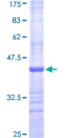 GUCY2D Protein - 12.5% SDS-PAGE Stained with Coomassie Blue.