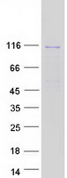 GUCY2D Protein - Purified recombinant protein GUCY2D was analyzed by SDS-PAGE gel and Coomassie Blue Staining