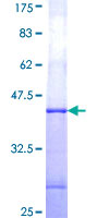 GUCY2F Protein - 12.5% SDS-PAGE Stained with Coomassie Blue.