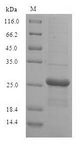 GUK1 / Guanylate Kinase 1 Protein - (Tris-Glycine gel) Discontinuous SDS-PAGE (reduced) with 5% enrichment gel and 15% separation gel.
