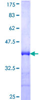 GUK1 / Guanylate Kinase 1 Protein - 12.5% SDS-PAGE Stained with Coomassie Blue.