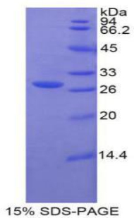 GUSB / Beta Glucuronidase Protein - Recombinant Glucuronidase Beta By SDS-PAGE