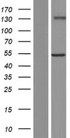 GXYLT2 Protein - Western validation with an anti-DDK antibody * L: Control HEK293 lysate R: Over-expression lysate