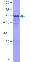 GYG1 / Glycogenin Protein - 12.5% SDS-PAGE of human GYG1 stained with Coomassie Blue