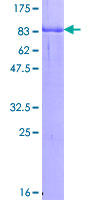 GYG2 Protein - 12.5% SDS-PAGE of human GYG2 stained with Coomassie Blue