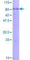 GYG2 Protein - 12.5% SDS-PAGE of human GYG2 stained with Coomassie Blue