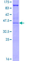 GYPA / CD235a / Glycophorin A Protein - 12.5% SDS-PAGE of human GYPA stained with Coomassie Blue