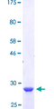 GYPB / CD235b / Glycophorin B Protein - 12.5% SDS-PAGE Stained with Coomassie Blue.