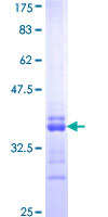 GYPC / Glycophorin C Protein - 12.5% SDS-PAGE Stained with Coomassie Blue.