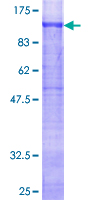 GYS1 / Glycogen Synthase Protein - 12.5% SDS-PAGE of human GYS1 stained with Coomassie Blue