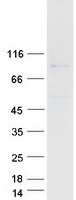 GYS1 / Glycogen Synthase Protein - Purified recombinant protein GYS1 was analyzed by SDS-PAGE gel and Coomassie Blue Staining