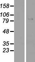 GYS2 Protein - Western validation with an anti-DDK antibody * L: Control HEK293 lysate R: Over-expression lysate
