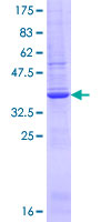 GYS2 Protein - 12.5% SDS-PAGE Stained with Coomassie Blue.