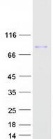 GYS2 Protein - Purified recombinant protein GYS2 was analyzed by SDS-PAGE gel and Coomassie Blue Staining