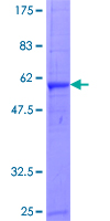 GZMA / Granzyme A Protein - 12.5% SDS-PAGE of human GZMA stained with Coomassie Blue
