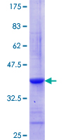 GZMA / Granzyme A Protein - 12.5% SDS-PAGE Stained with Coomassie Blue.