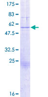 GZMB / Granzyme B Protein - 12.5% SDS-PAGE of human GZMB stained with Coomassie Blue