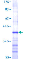 GZMB / Granzyme B Protein - 12.5% SDS-PAGE Stained with Coomassie Blue.